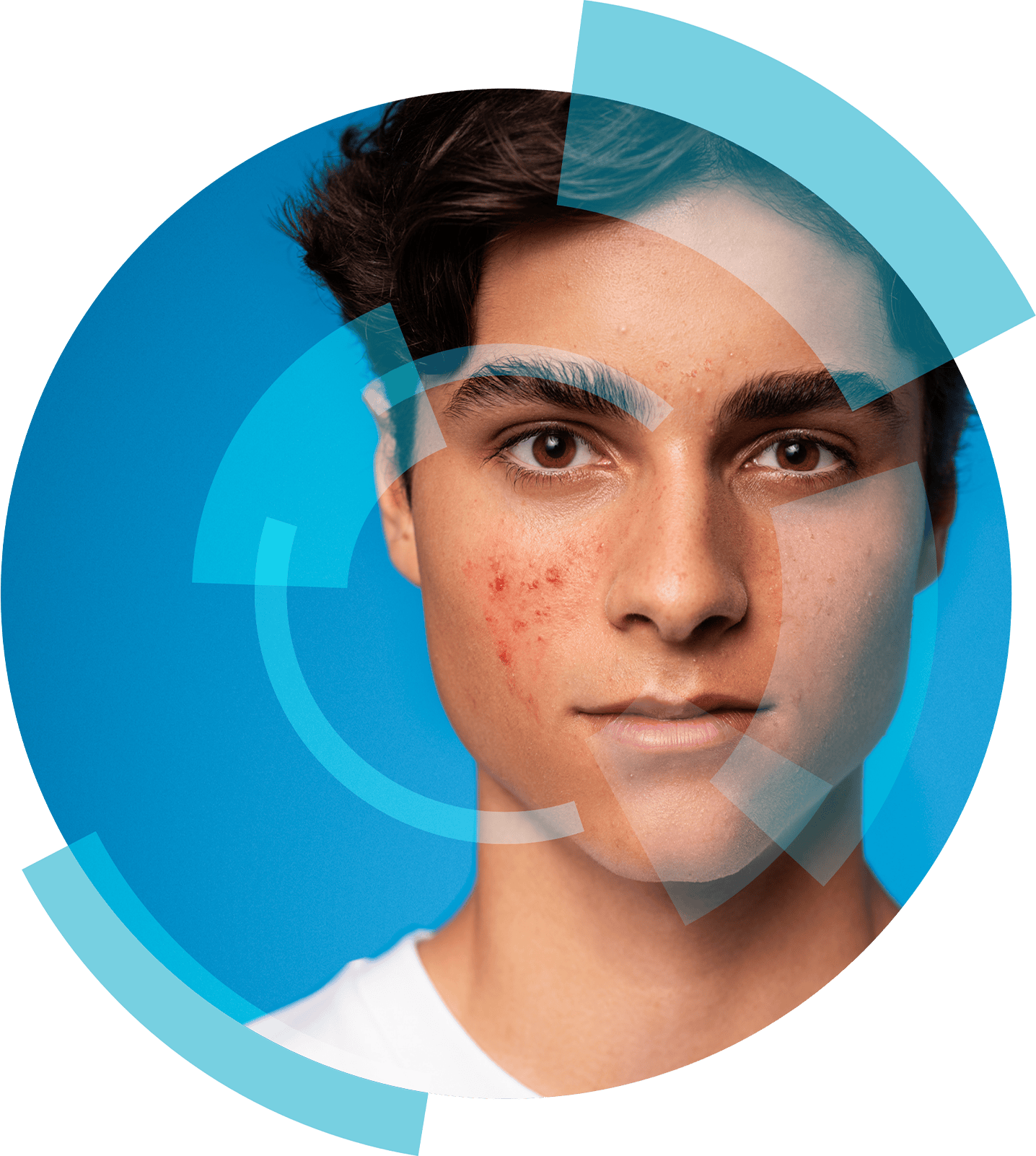 In monotherapy as maintenance