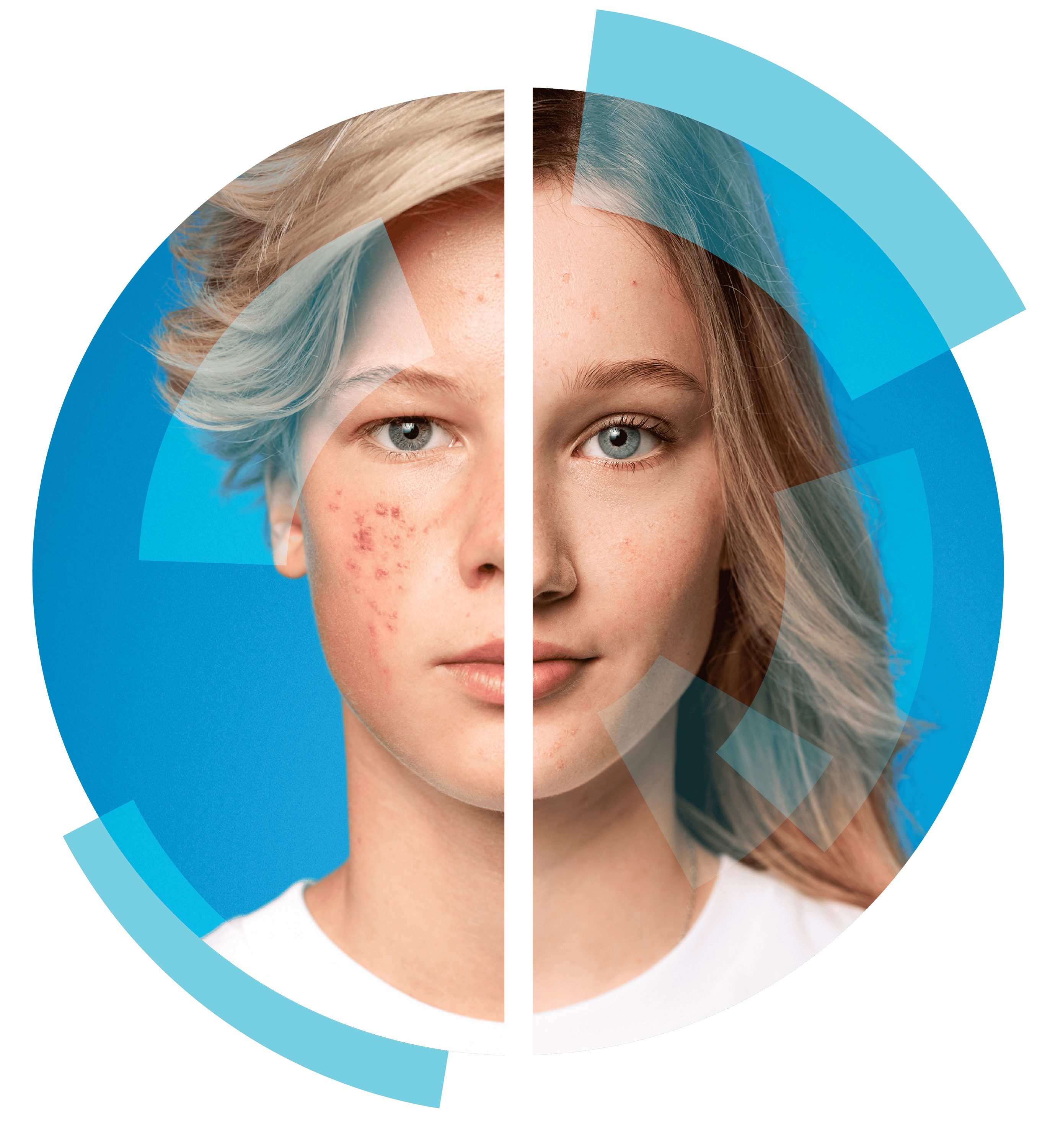 Adolescent males and females