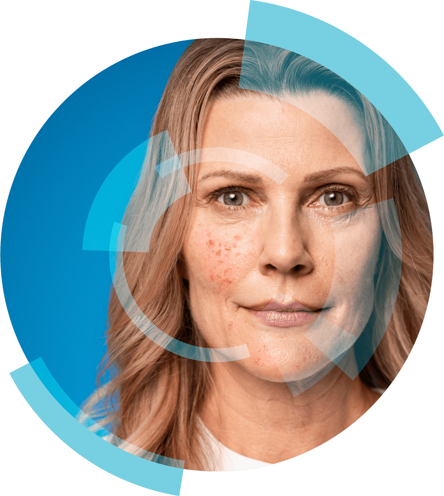 During and after menopause